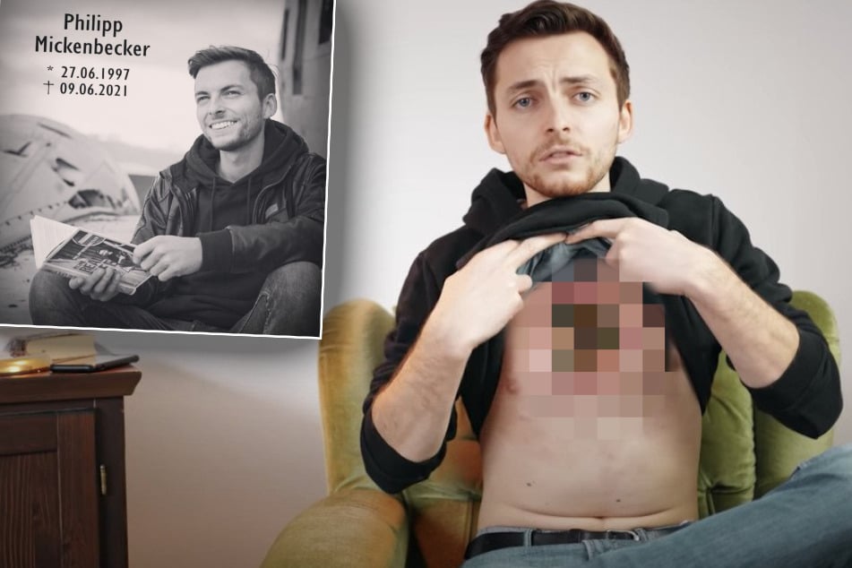 Der Krebs "zerfraß" seinen Körper: Verstorbener Youtube-Star (†23) wird zum Filmhelden
