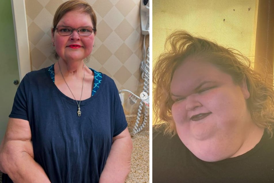 Das linke Foto zeigt Tammy nach ihrer starken Gewichtsabnahme im April 2024. Im Jahr 2020 wog die Frau noch über 300 Kilogramm (Foto rechts: Tammy im Juli 2021).