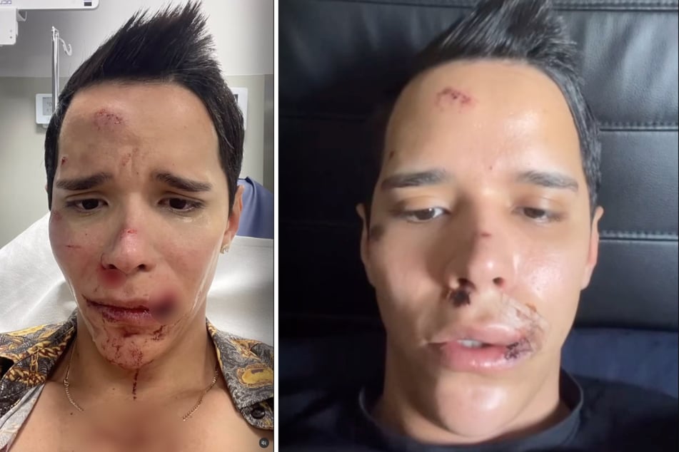 Breimer Rosas ist in Leipzig Opfer einer gewalttätigen Auseinandersetzung geworden.