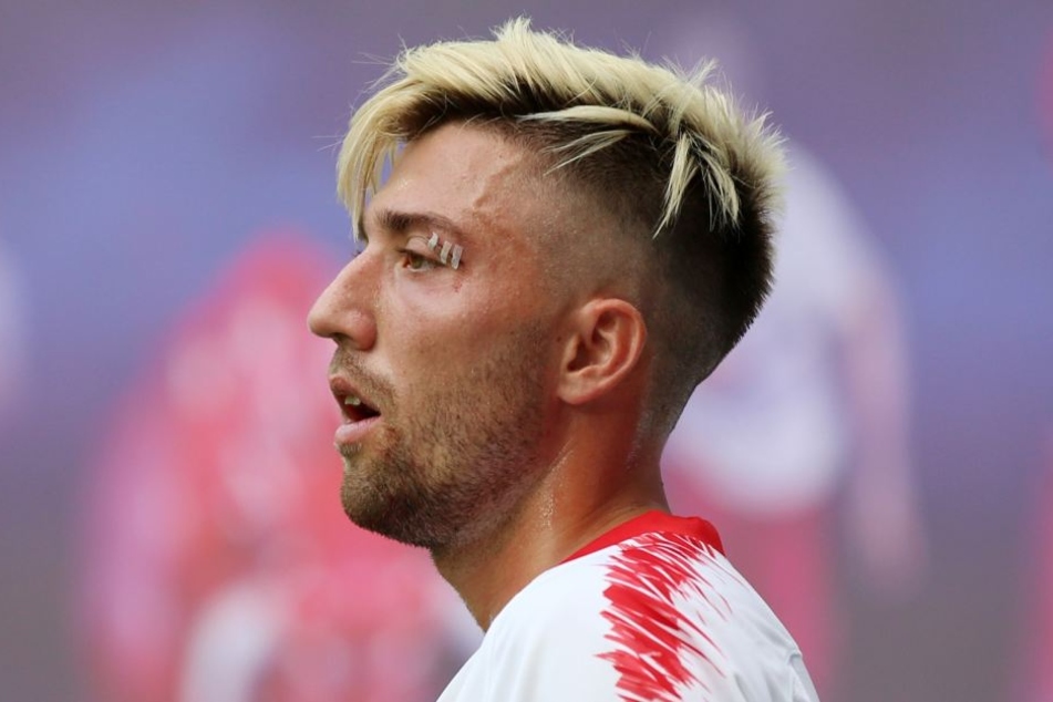 Kevin Kampl holte sich im Drittrunden-Hinspiel gegen Craiova einen Cut über dem linken Auge. Gegen Luhansk fehlt er nun wegen einer Muskelverletzung.