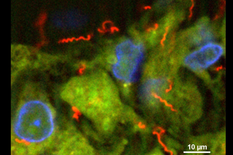 Wissenschaftler konnten den Syphilis-Erreger im Labor vergrößert festhalten: Spiralbakterien (rot) im Gewebe (grün) mit Zellkernen (blau).