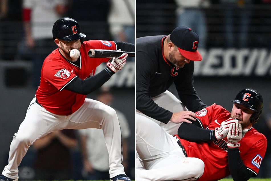 David Fry suffered multiple facial fractures after being hit by a pitch on Tuesday night.