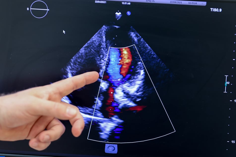 Marcel Vollroth, Oberarzt der Kinderherzchirurgie, erläutert ein Ultraschallbild des neuen Herzens eines der Zwillinge bei einer Nachsorgeuntersuchung am Herzzentrum Leipzig.