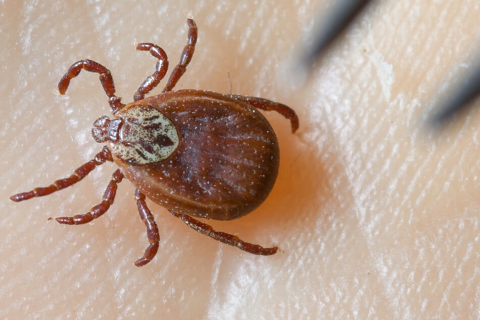 Zecken-Sommer in Sachsen: Immer mehr Borreliose-Fälle