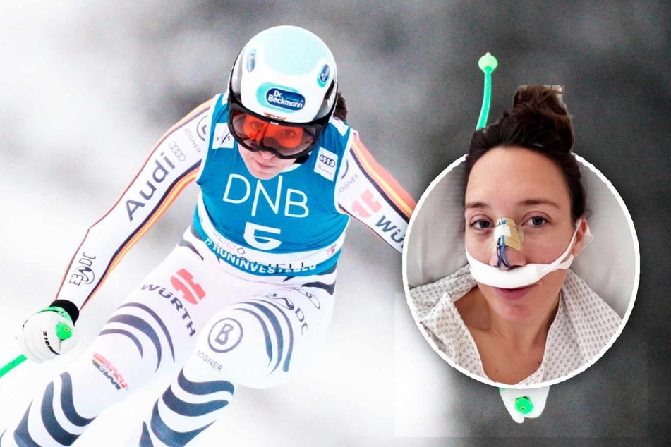 Deutscher Ski-Star kracht beim Training gegen Stange und bricht sich die Nase
