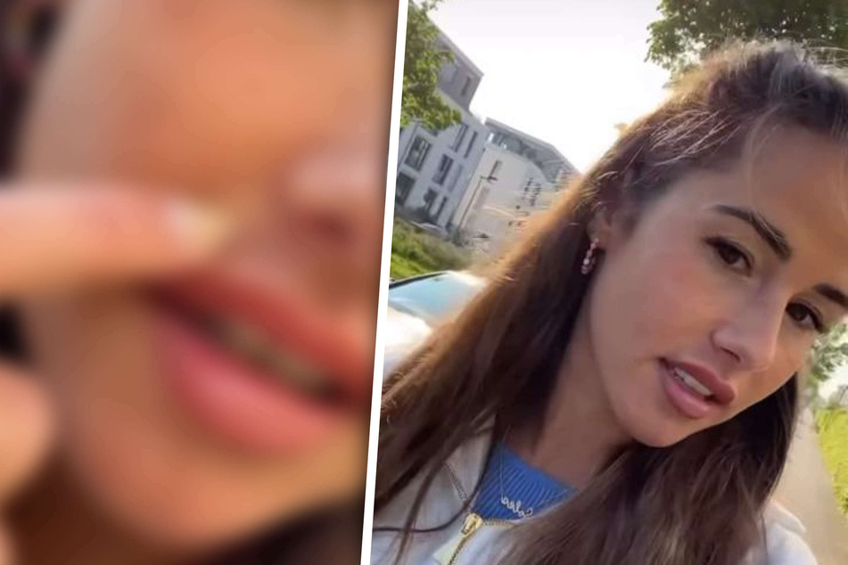 Sarah Engels mit kosmetischem Problem: "Als hätte ich einen Schnurrbart"