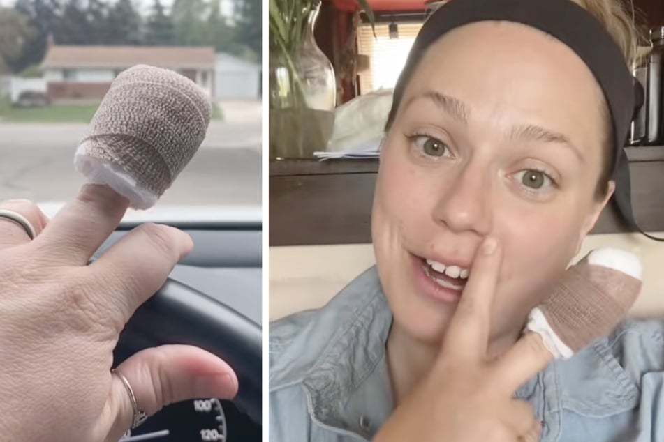 Kara Marie (35) wurde von ihrer Katze in den Finger gekratzt - daraufhin folgten mehrere Arztbesuche.