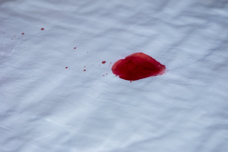 Blutflecken entfernen: So bekommt man Blut aus Textilien