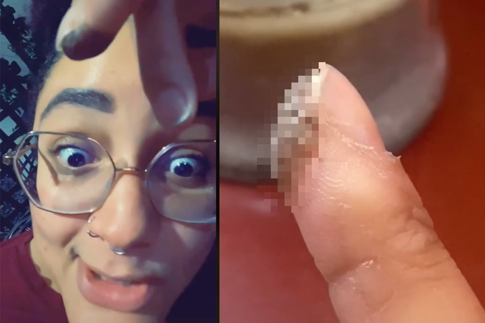 Frau wachsen Schamhaare am Finger! Irre Geschichte aus ihrer Kindheit ist schuld