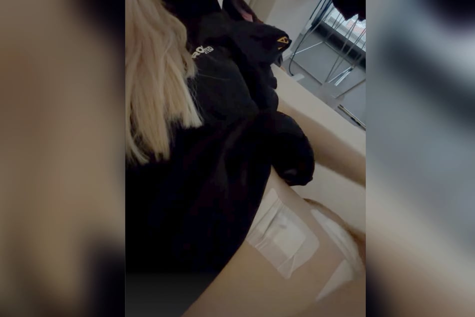 Nach dem Eingriff hat die 25-Jährige große Pflaster am Bauch.