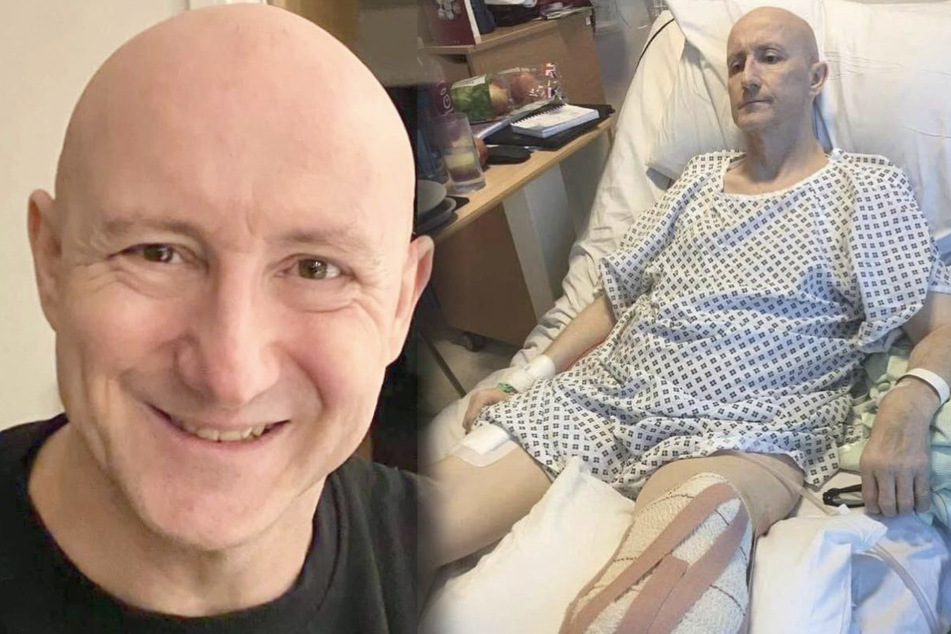 Dave Mears hat sein linkes Bein verloren. Ob dies mit der AstraZeneca-Impfung zusammenhängt, können Ärzte nicht bestätigen - aber auch nicht ausschließen.