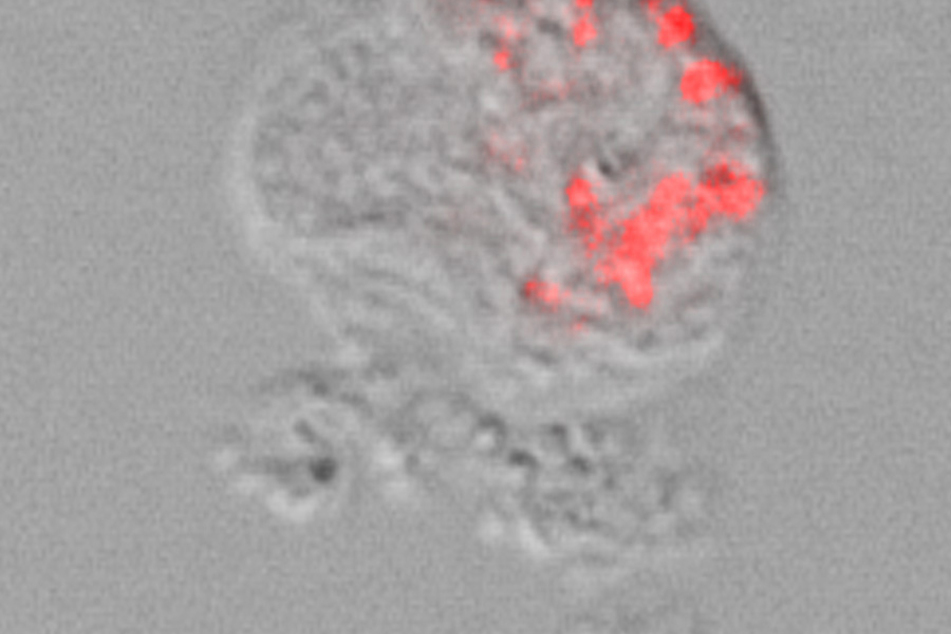 Lichtmikroskopische Aufnahme einer Amöbe der Thecofilosea mit intrazellulären Legionellales-Bakterien. Die Bakterien wurden mittels "Fluoreszenz-in-situ-Hybridisierung" rot angefärbt.