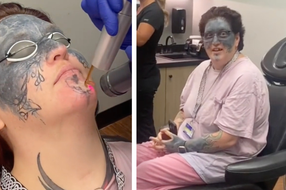 Woman gets tattoo on her face against her will – and a stroke of luck on TikTok