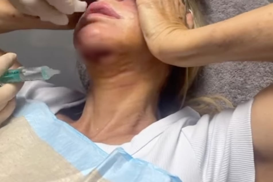 Carmen Geiss (60) wurde nach dem brutalen Überfall im Krankenhaus behandelt. An ihrem Hals war eine tiefe Schnittwunde sichtbar.