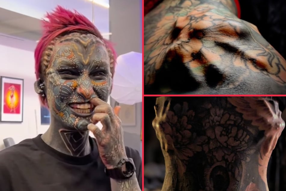 Body modification fanatic gets "spiders" implanted under chest