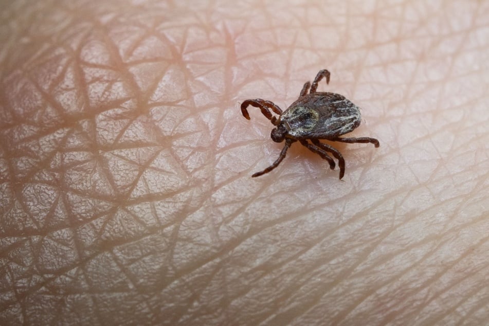 Zecken übertragen am häufigsten die von Bakterien verursachte Borreliose, deren Symptome denen einer Grippe ähneln. (Symbolbild)