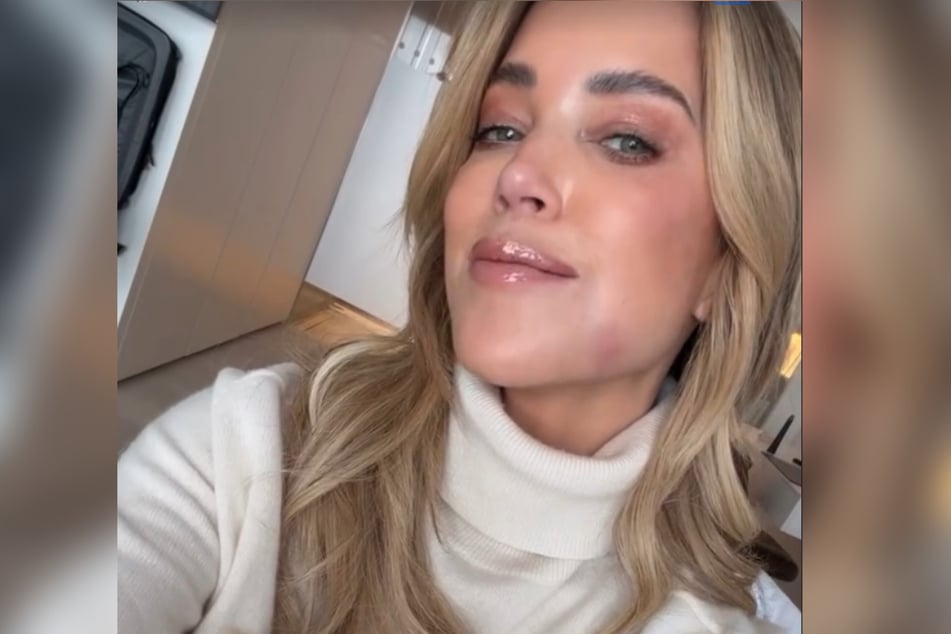 Sylvie Meis (47) sah sich zu einem nächtlichen Zahnarztbesuch gezwungen.