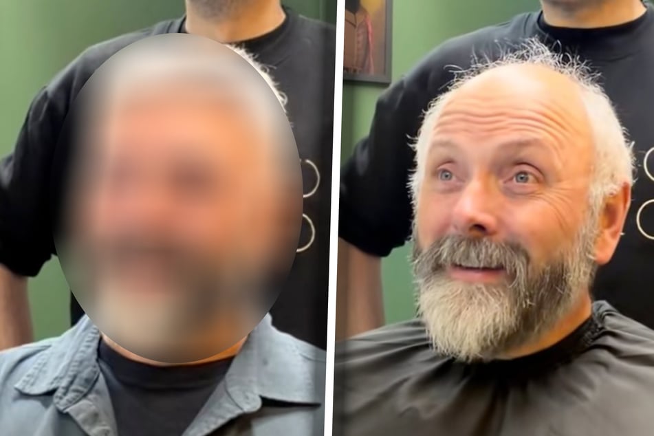 Mann ist platt, als er sich nach Jahrzehnten mit vollem Haar sieht: "Ganz andere Person"