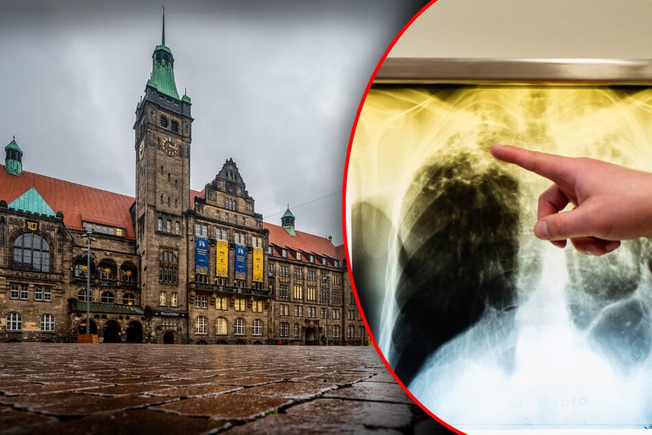 Chemnitz: Tuberkulose in Chemnitz: Verdachtsfälle haben sich bestätigt!
