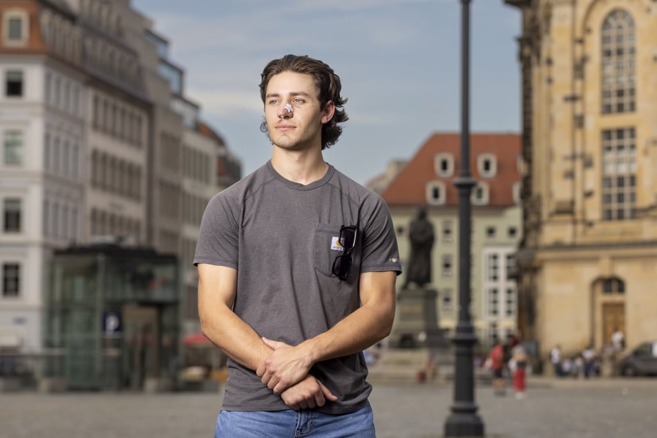 John Rudat (21) verlor bei dem Angriff in der Linie 7 beinahe seine Nase.