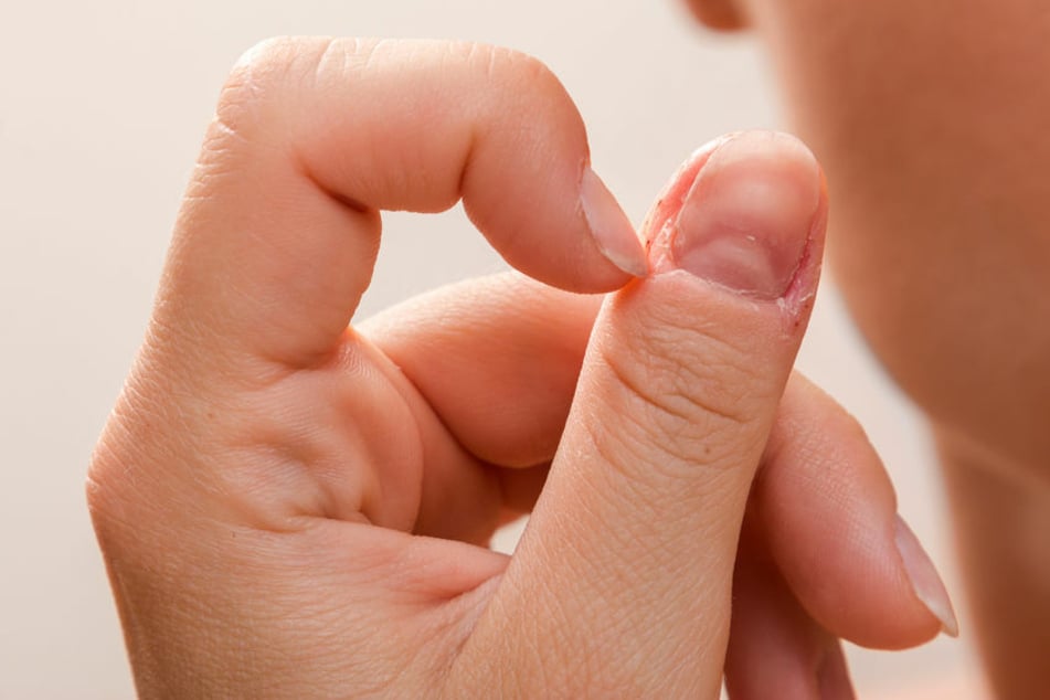 Ob Fingernägel kauen, am Finger knabbern oder pulen - keiner dieser Angewohnheiten ist gut. (Symbolbild)