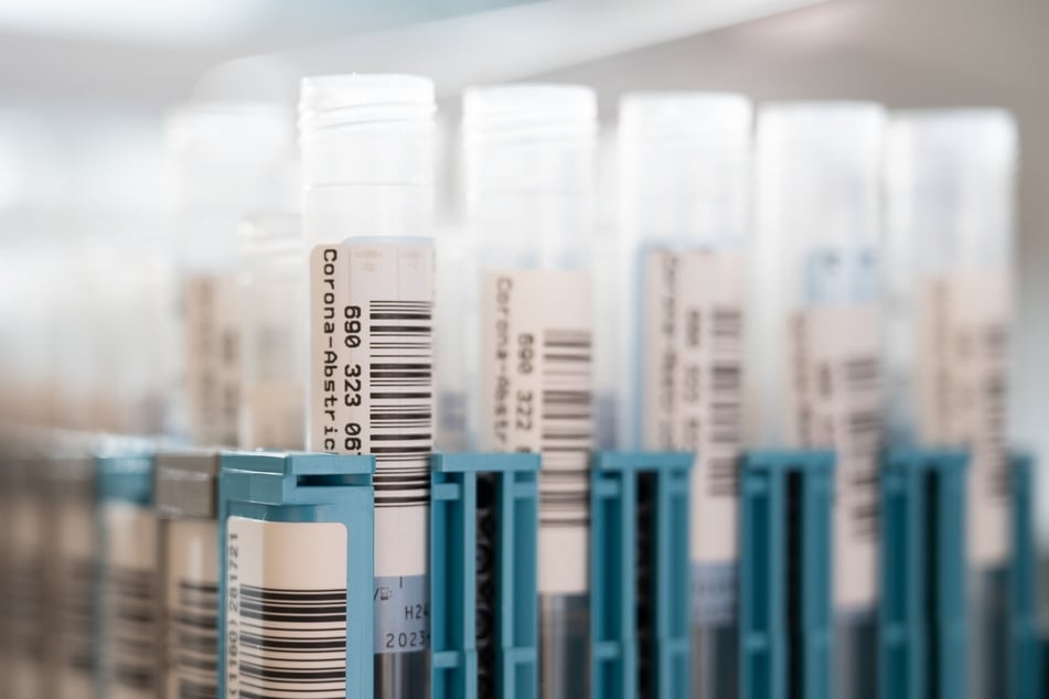 Unter anderem im Medizinischen Labor Ostsachsen in Dresden werden Corona-Abstriche unter Verwendung der PCR-Methode auf das Virus untersucht.