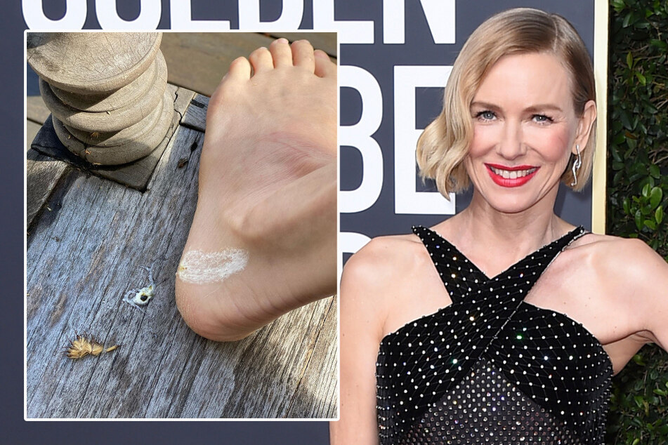 Wie auch immer der Vogelflatschen auf Naomi Watts' Fuß gelandet ist, möge er ihr Glück bringen!
