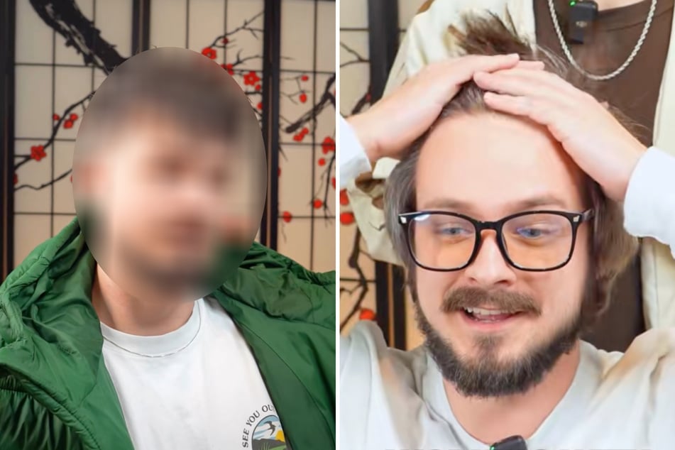 Mann hasst seine hohe Stirn: Doch nach Umstyling ist er nicht wiederzuerkennen