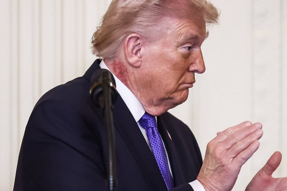 The White House said that President Donald Trump is using some form of preventative treatment on the blotchy red rash on his neck.