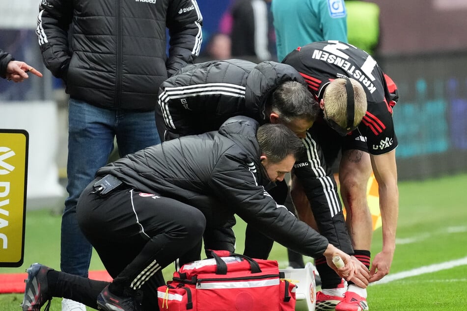 Rasmus Kristensen (r.) war nach seiner Verletzung in der Halbzeit der Partie gegen Mönchengladbach in der Kabine geblieben.