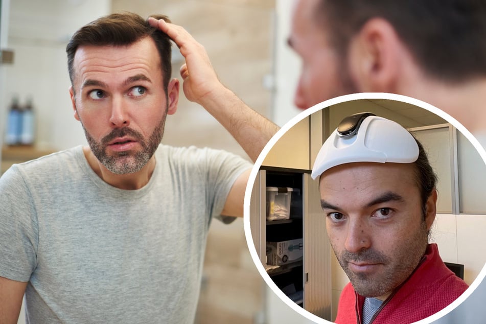 Die große Sorge vieler Männer: Was tun bei Haarausfall? Vielleicht hilft die Haarwuchs-Erfindung von Carlos Chacón Martínez (42, r.).