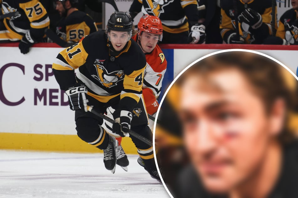 Puck im Gesicht: Eishockey-Star zeigt seine Aua-Wunde!