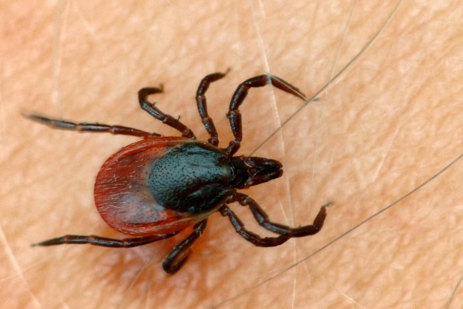 Zecken: Immer wieder sorgen die kleinen Parasiten für Ärger. In Sachsen stieg die Zahl der Borreliose-Fälle im Vergleich zu 2023 rasant an.