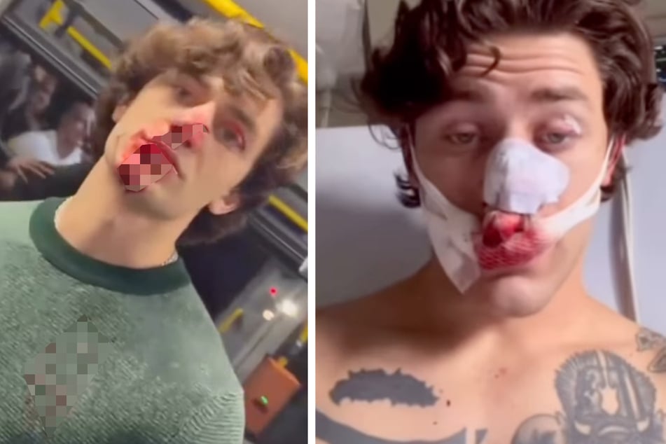 Das verwundete Opfer John Rudat repostete nach dem schockierenden Vorfall zwei Videos - aus der Tram (l.) und der Klinik.