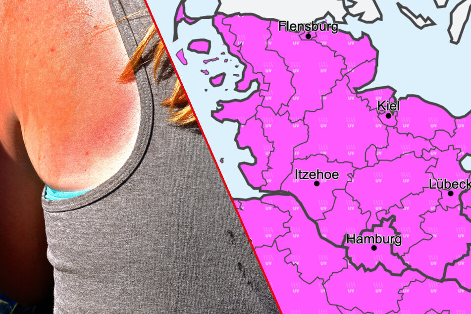 Sonnenbrandgefahr! Warnung vor ungewöhnlich hoher UV-Strahlung