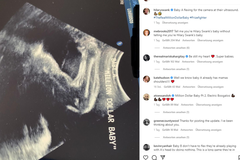 Hilary Swank shared an ultrasound photo of one of her unborn twins on Instagram.