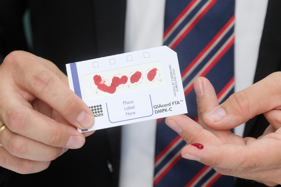 Sebastian Gemkow (CDU), Wissenschaftsminister des Landes Sachsen, zeigt die Testkarte mit Blut für einen neuen Corona-Antikörpertest.