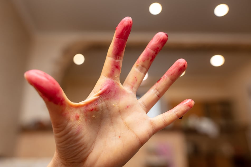 Beim Rote Beete schneiden können schon mal farbige Rückstände an den Fingern zurückbleiben.