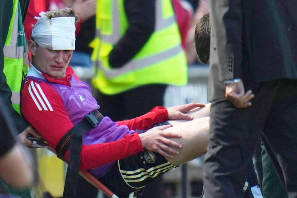 Jack MacKenzie (24) wurde nach der Partie zwischen dem FC Aberdeen und Dundee United schwer am Kopf verletzt.