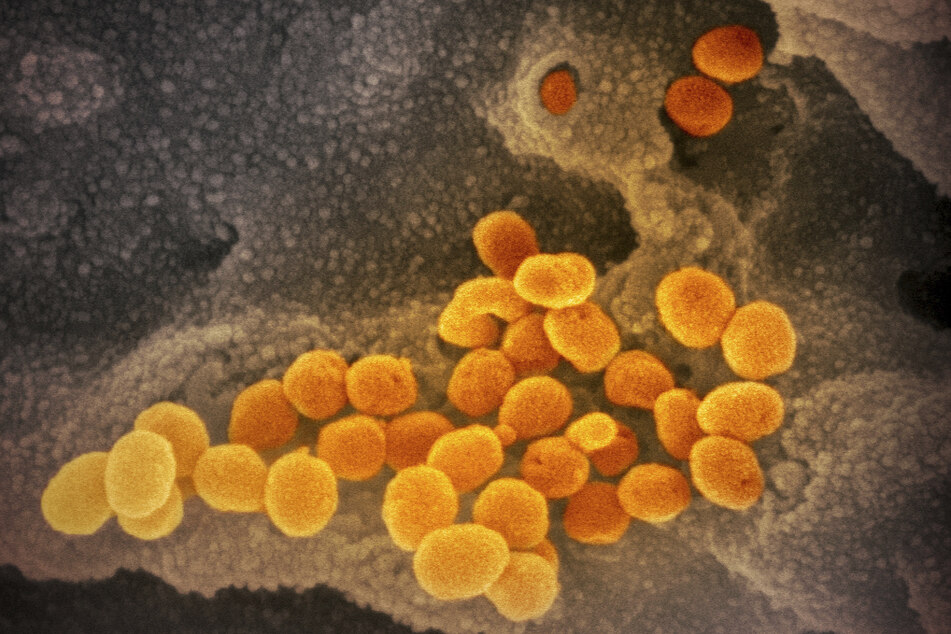 Eine elektronenmikroskopische Aufnahme des "U.S. National Institute of Health" zeigt das neuartige Coronavirus (SARS-CoV-2) (orange), das aus der Oberfläche von im Labor kultivierten Zellen (grau) austritt. Die Probe wurde von einem Patienten in den USA isoliert.