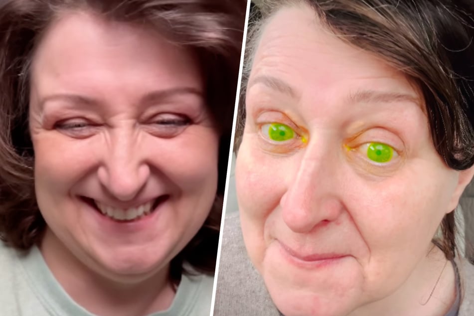 Margerita ma po wizycie u lekarza jadowo zielone oczy: „To nie jest filtr!”