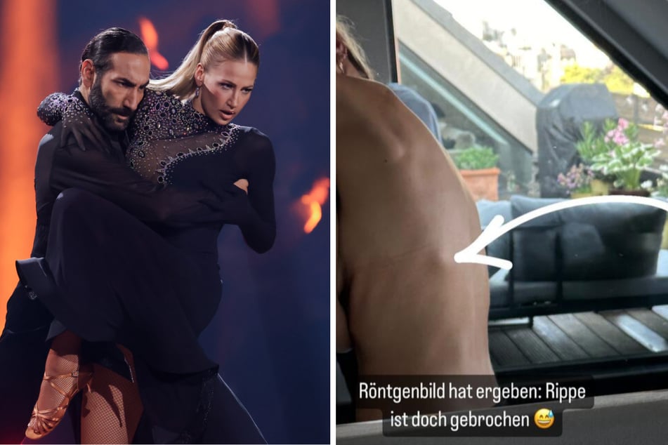 Lulu Lewe (32) brach sich bei "Let's Dance" tatsächlich eine Rippe. Die 32-Jährige ging an der Seite von Profi Massimo Sinató (43) an den Start.