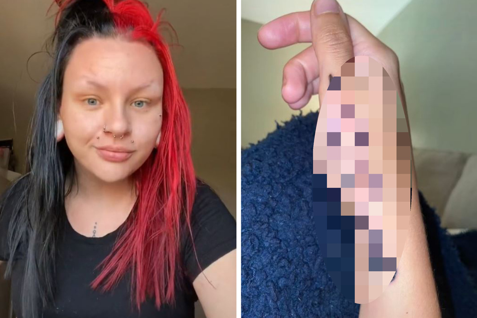 Frau lässt sich Messer-Bild auf Hand tätowieren: Das Ergebnis schockiert sie