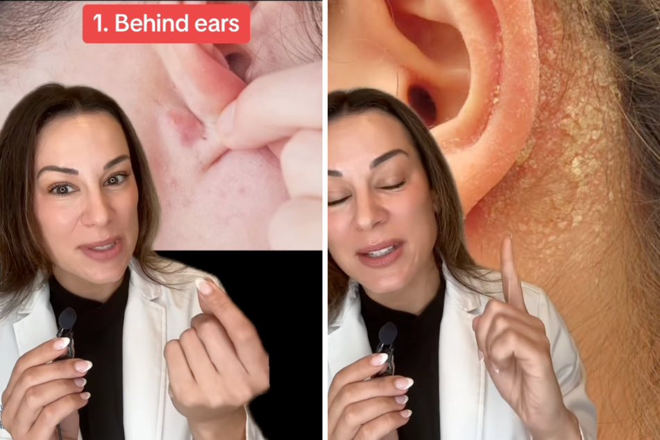 Hinter den Ohren lauern viele Gefahren. Oft lohnt es sich mit dem Finger vorsichtig nach Schmutz zu tasten.