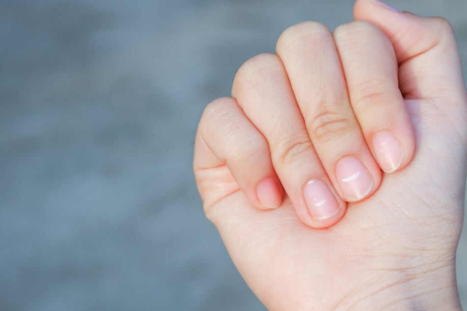 The secrets your nails can reveal about your health