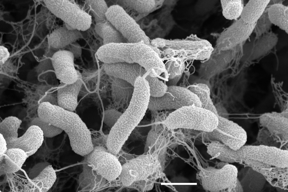 Vibrionen sind stäbchenförmige Bakterien.