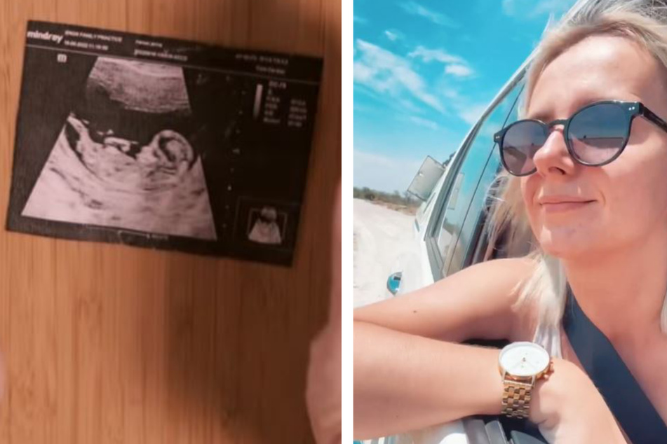Frohe Baby-News: Anna Heiser ist wieder schwanger!