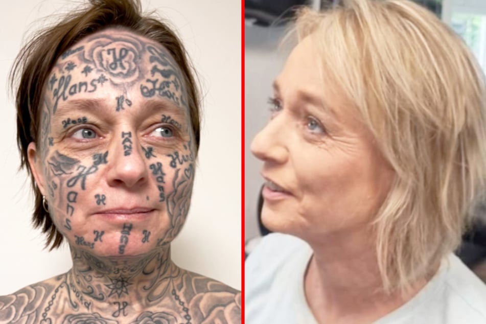 A woman who was "forced" to get 250 tattoos of her partner's name has undergone a radical transformation to remove the inkings.