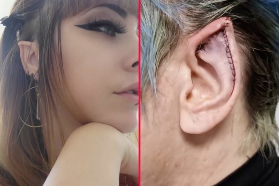 Aneta Von Cyborg has made a name for herself slicing up people's ears and stitching them back together to look like those of an elf.