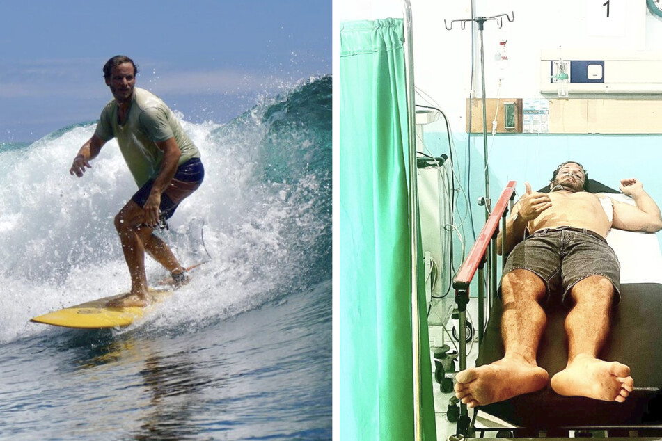 Surfer will aufs offene Meer hinauspaddeln, dann durchbohrt ein Fisch seine Lunge